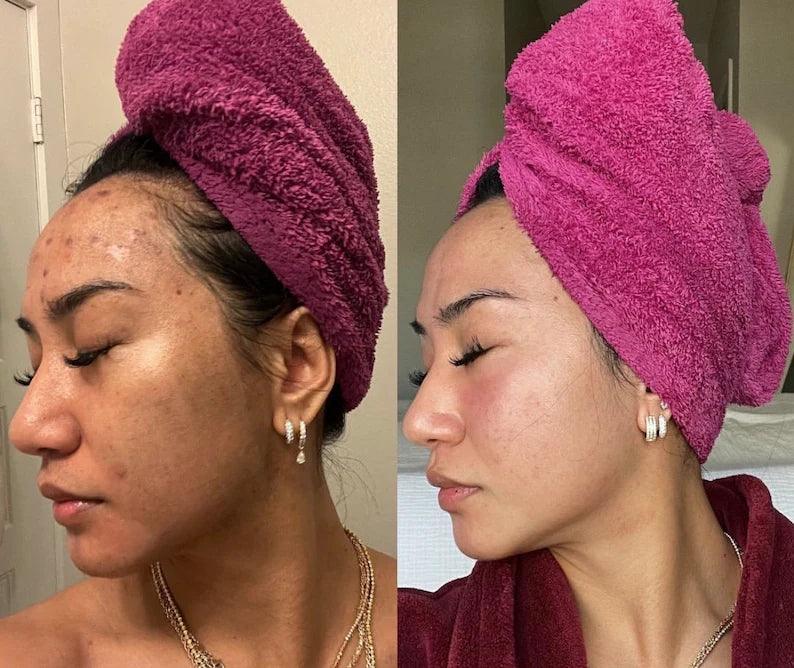 Korean SkinCare Toner Pads